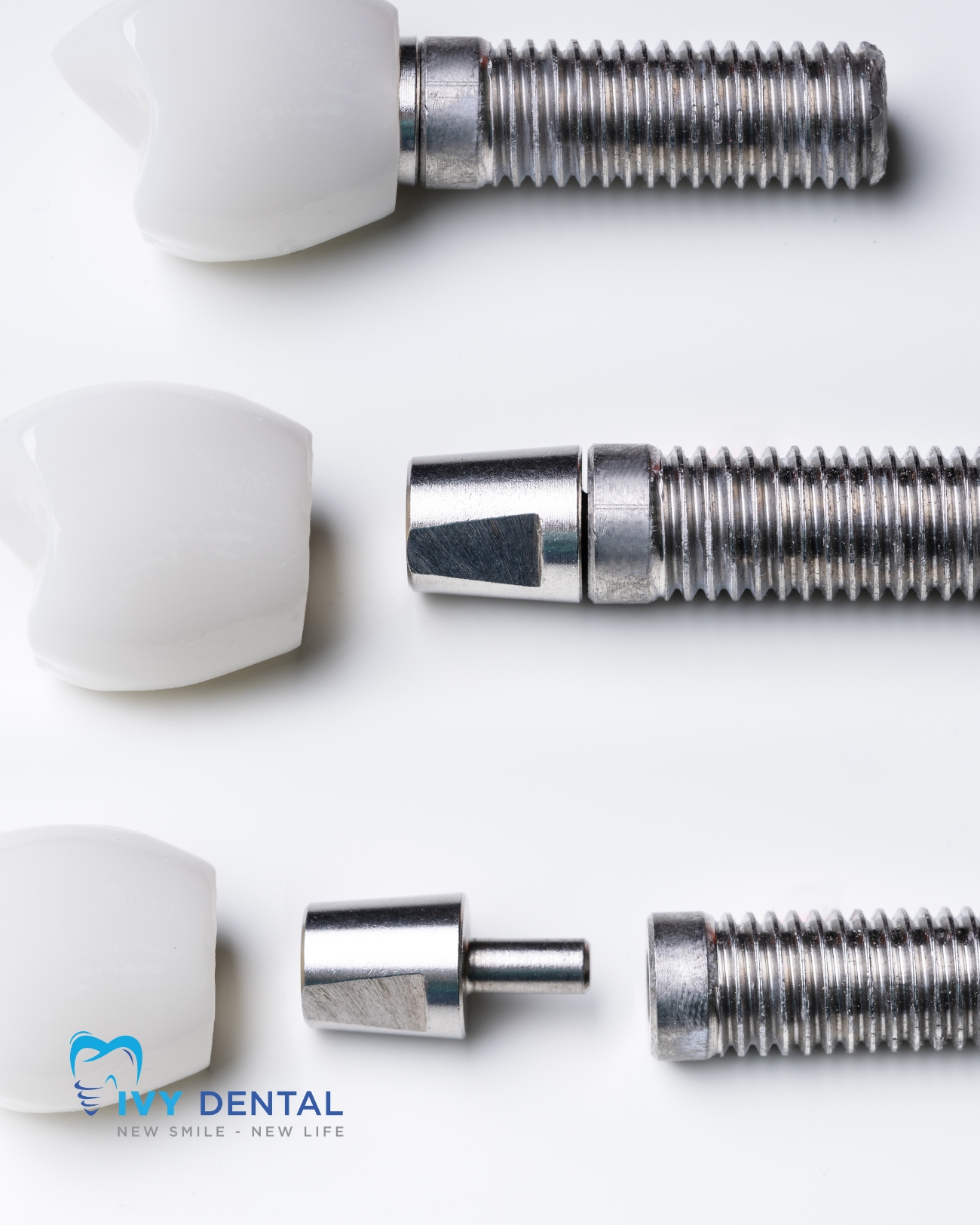 nha khoa ivy  -Quy trình cấy ghép Implant-compressed