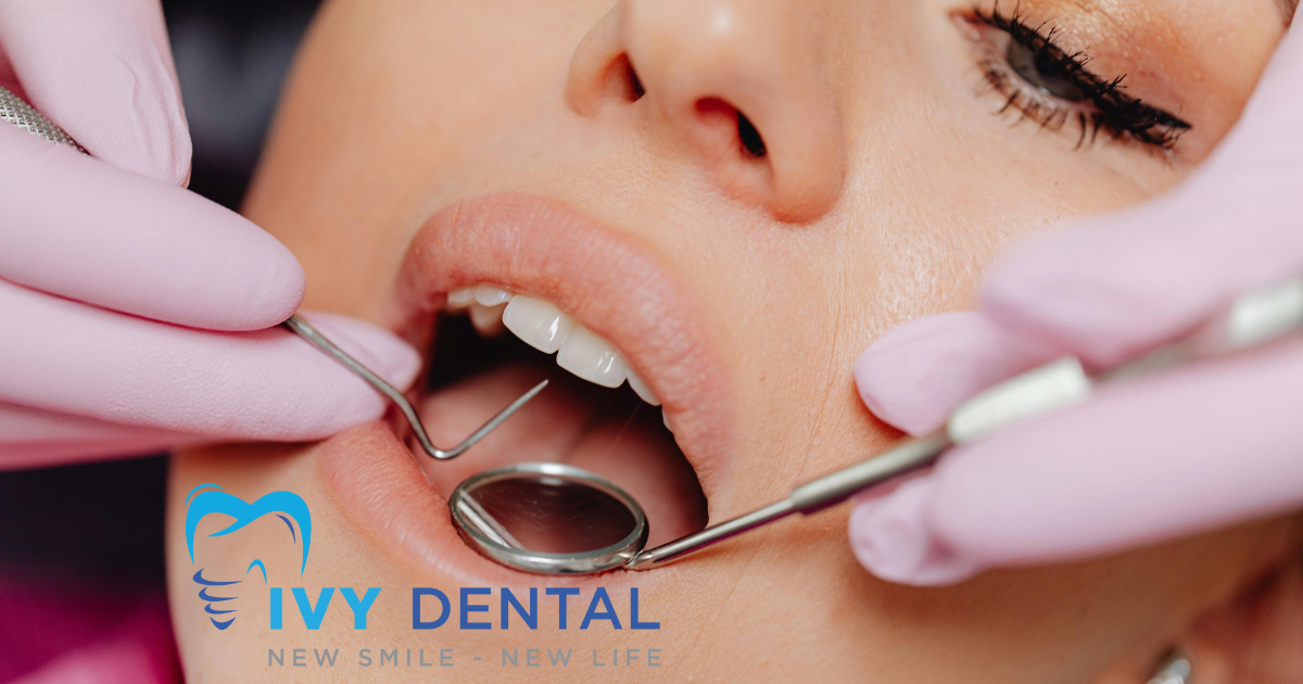 nha khoa ivy- Mặt dán sứ Veneer Lựa chọn tối ưu cho nụ cười hoàn mỹ