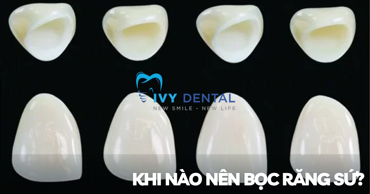 nha khoa ivy - Khi nào nên bọc răng sứ - Chuyên gia Nha Khoa Ivy giải đáp