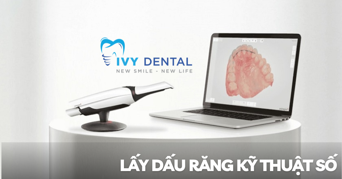 nha khoa ivy - Lấy dấu răng kỹ thuật số - Công nghệ hiện đại cho nụ cười hoàn hảo tại Nha khoa Ivy