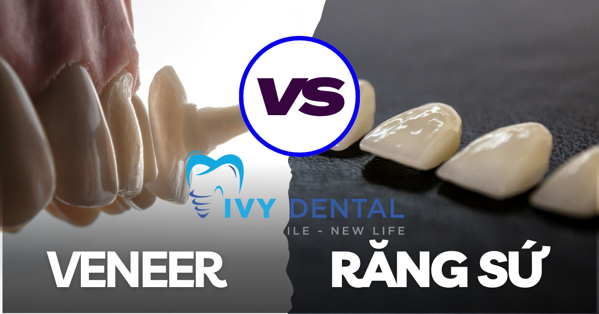 nha khoa ivy - Mặt dán sứ Veneer và bọc răng sứ Lựa chọn nào tối ưu hơn