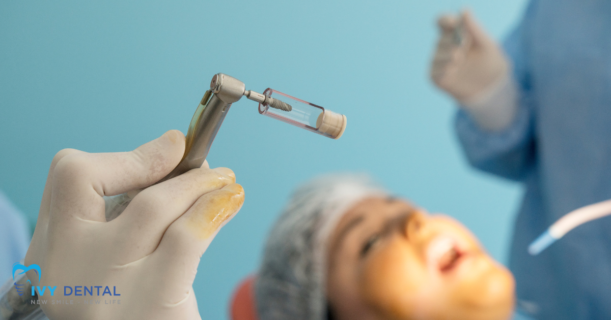 nha khoa ivy Tiêu Chí Lựa Chọn Nha Khoa Uy Tín Để Cấy Ghép Implant