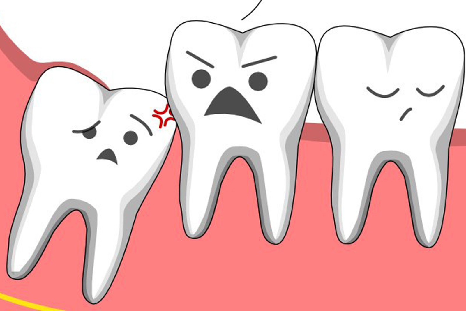 Bạn đang muốn có một cái nhìn tốt hơn về quá trình nhổ răng khôn? Hãy xem hình ảnh này để hiểu thêm về quá trình này, đồng thời giúp bạn thoải mái hơn trong quá trình này.
