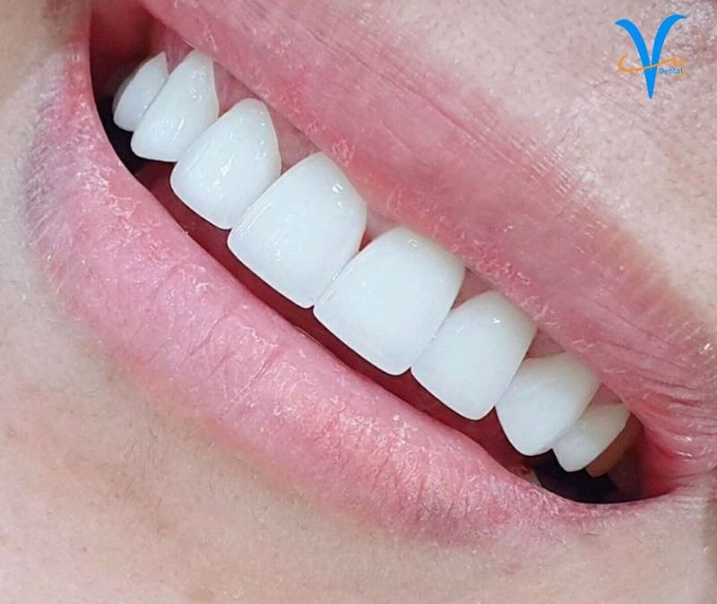 3 Yếu Tố Quan Trọng Để Chọn Được Trung Tâm Chỉnh Nha Chất Lượng