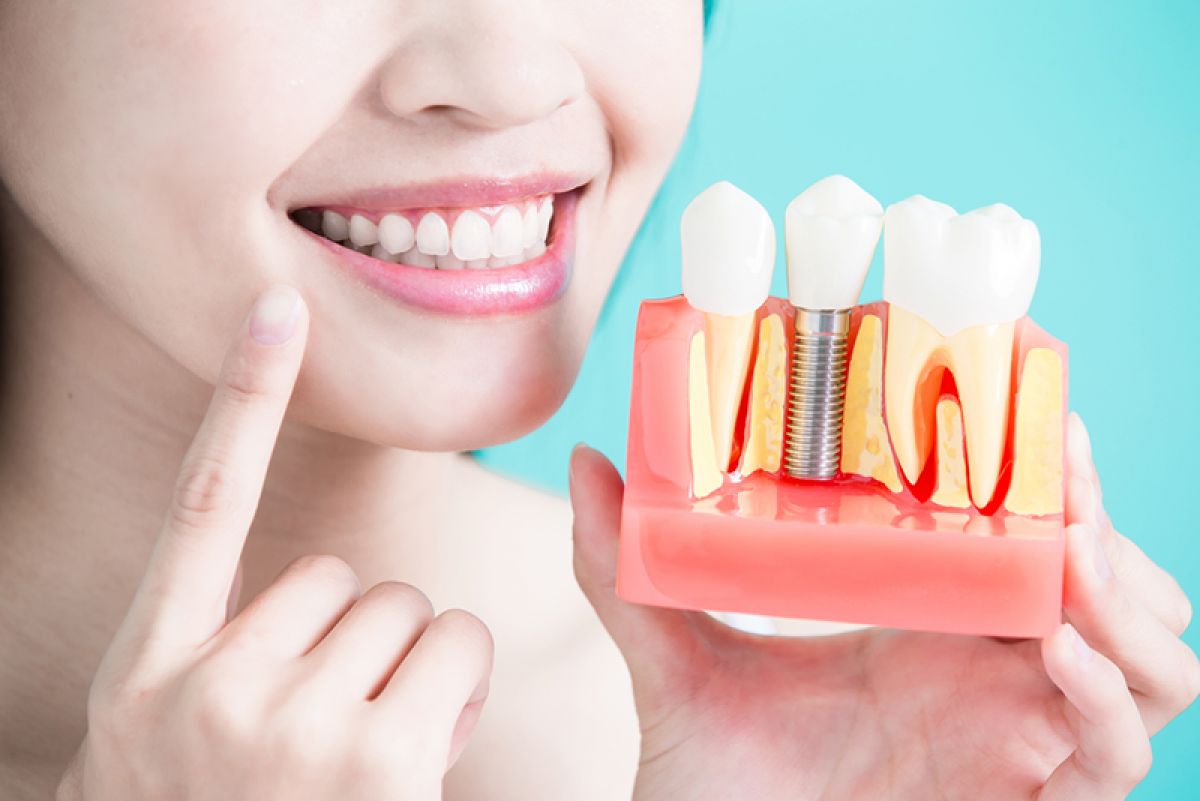 IMPLANT - Chỉ định, ưu và nhược điểm