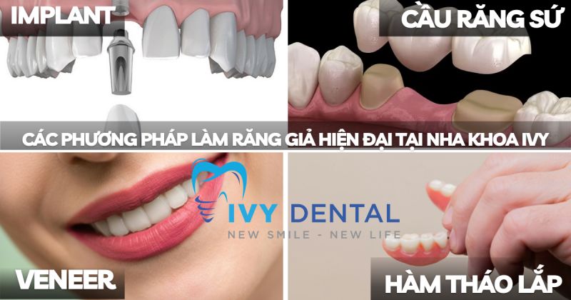 Các Phương Pháp Làm Răng Giả Hiện Đại Tại Nha Khoa Ivy - Bình Thạnh