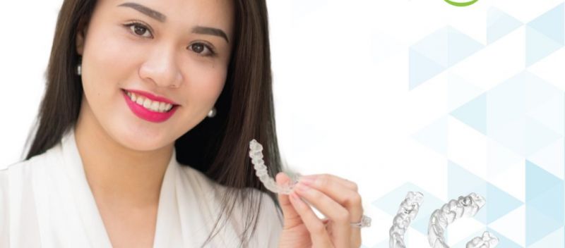 Niềng răng bằng khay Invisalign