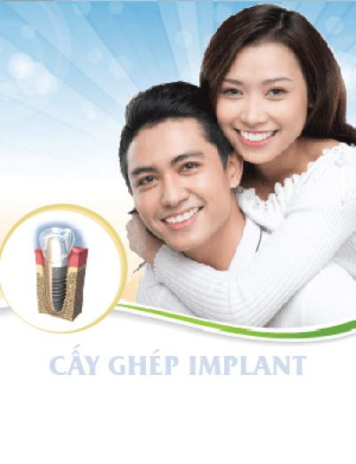 Cấy Ghép Implant Là Gì?