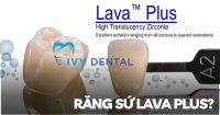 Răng Sứ | Răng sứ Lava Plus Giải pháp phục hình răng hoàn hảo tại Nha khoa Ivy | Nha Khoa Ivy - Bình Thạnh