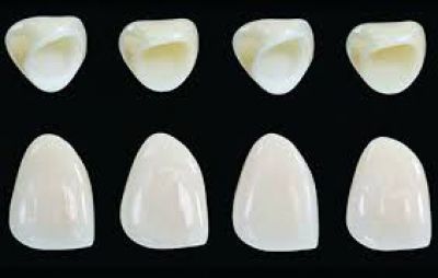 Trồng Răng Sứ Khi Bị Mất Răng Hay Cấy Ghép Implant?
