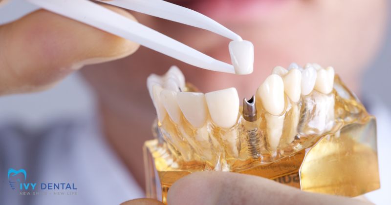 Xử Lý Các Biến Chứng Implant: Nhiễm Trùng, Tiêu Xương, Viêm Nướu | Nha Khoa Ivy - Bình Thạnh