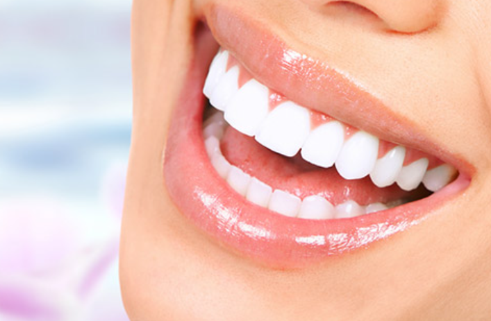 Dán Sứ Veneer Thẩm Mỹ
