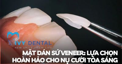 Mặt dán sứ Veneer Lựa chọn hoàn hảo cho nụ cười tỏa sáng | Nha khoa Ivy – Bình Thạnh