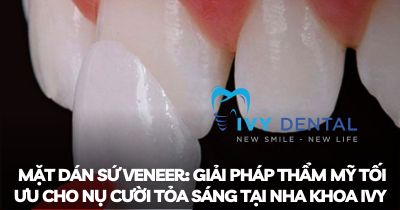 Mặt dán sứ Veneer: Giải pháp thẩm mỹ tối ưu cho nụ cười tỏa sáng tại Nha khoa Ivy | Nha Khoa Ivy – Bình Thạnh
