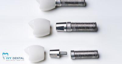 Ưu điểm của implant STRAUMANN BLX | Nha khoa Ivy – Bình Thạnh