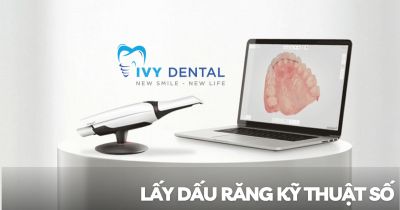 Răng Sứ | Lấy dấu răng kỹ thuật số – Công nghệ hiện đại cho nụ cười hoàn hảo tại Nha khoa Ivy | Nha Khoa Ivy – Bình Thạnh
