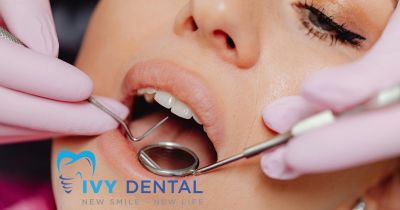 Mặt dán sứ Veneer: Lựa chọn tối ưu cho nụ cười hoàn mỹ | Nha khoa Ivy – Bình Thạnh