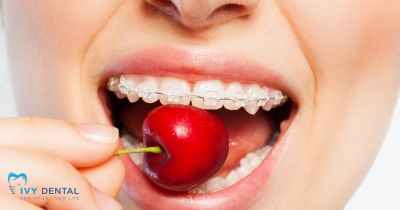 Cấy Ghép Implant Nên Ăn Gì Và Kiêng Gì? | Nha Khoa Ivy – Bình Thạnh