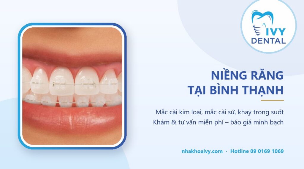 Niềng răng tại Bình Thạnh – Nha Khoa Ivy