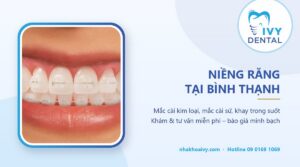 Niềng răng Bình Thạnh: Bảng giá & địa chỉ uy tín