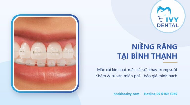Niềng răng Bình Thạnh: Bảng giá & địa chỉ uy tín