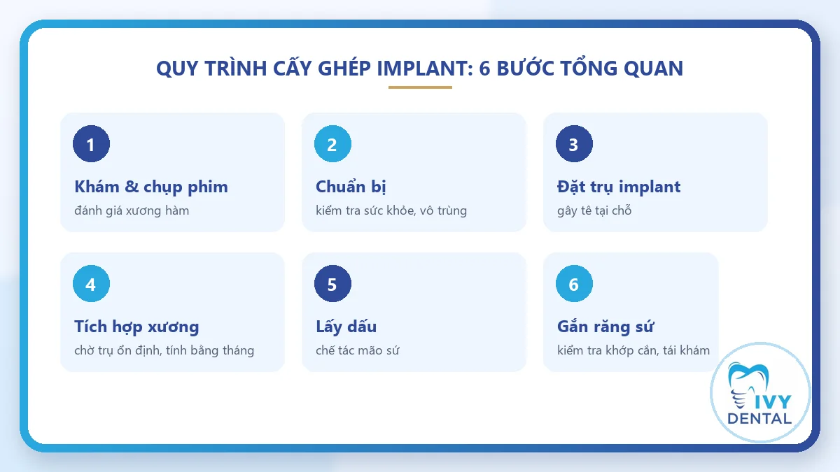 Sáu bước tổng quan của quy trình cấy ghép răng implant