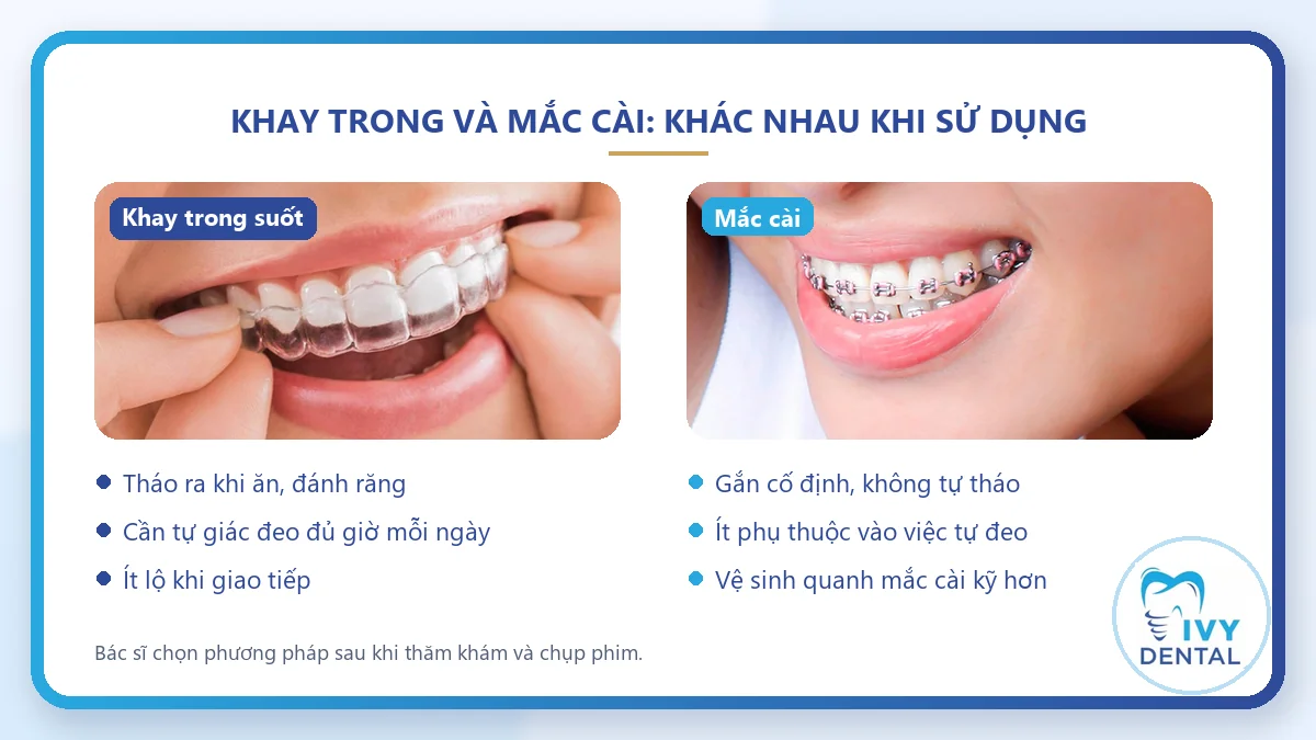 So sánh khay niềng răng trong suốt và mắc cài theo cách đeo, vệ sinh, tuân thủ