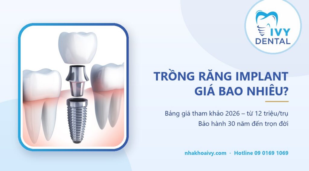 Trồng răng Implant giá bao nhiêu – Nha Khoa Ivy